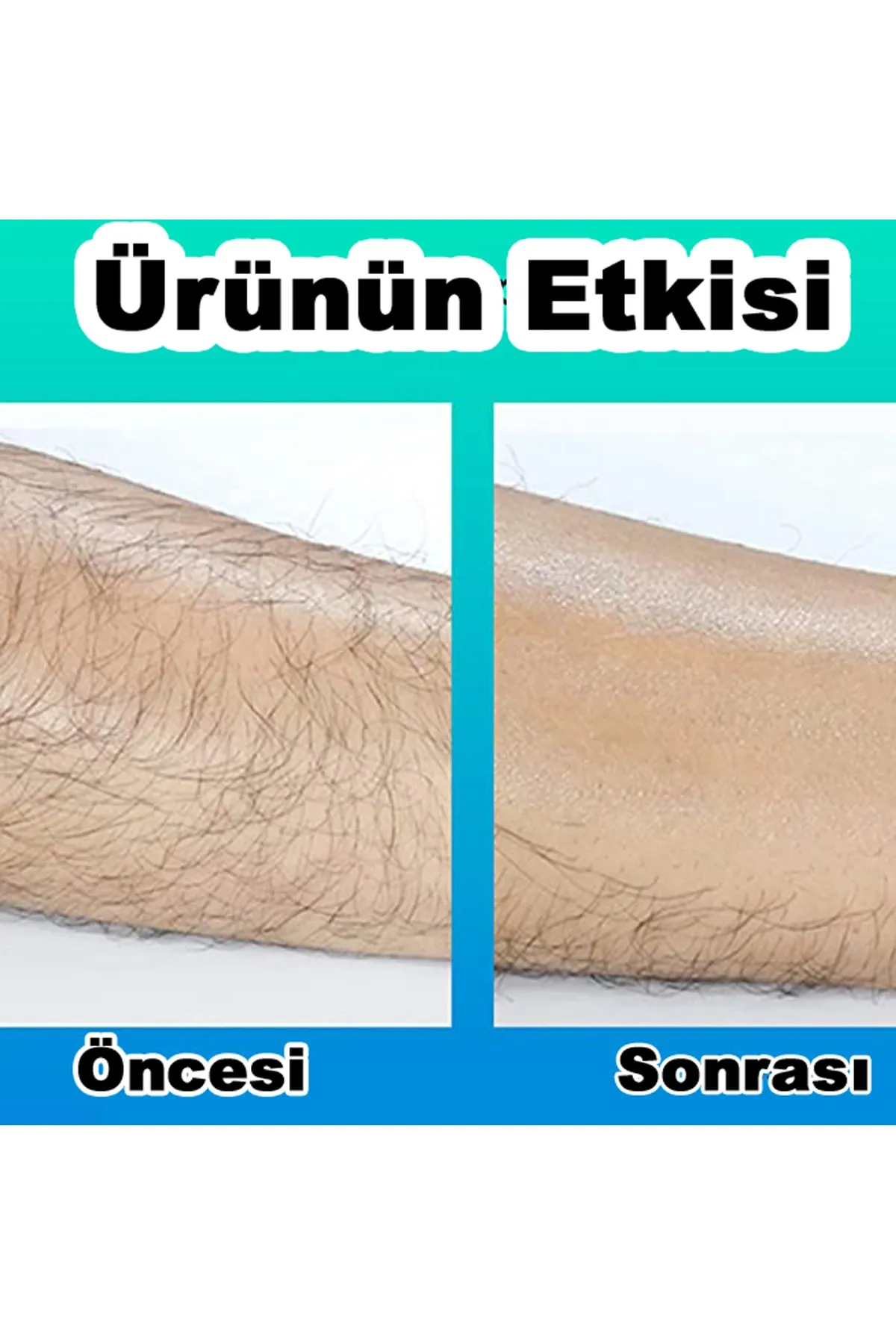 Moda Beauty Kristal Epilatör Siyah