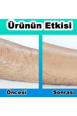 Moda Beauty Kristal Epilatör Siyah
